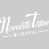 Newcastle Tattoo Removals