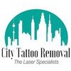 City Tattoo Removal