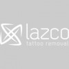 Lazco Tattoo Removal